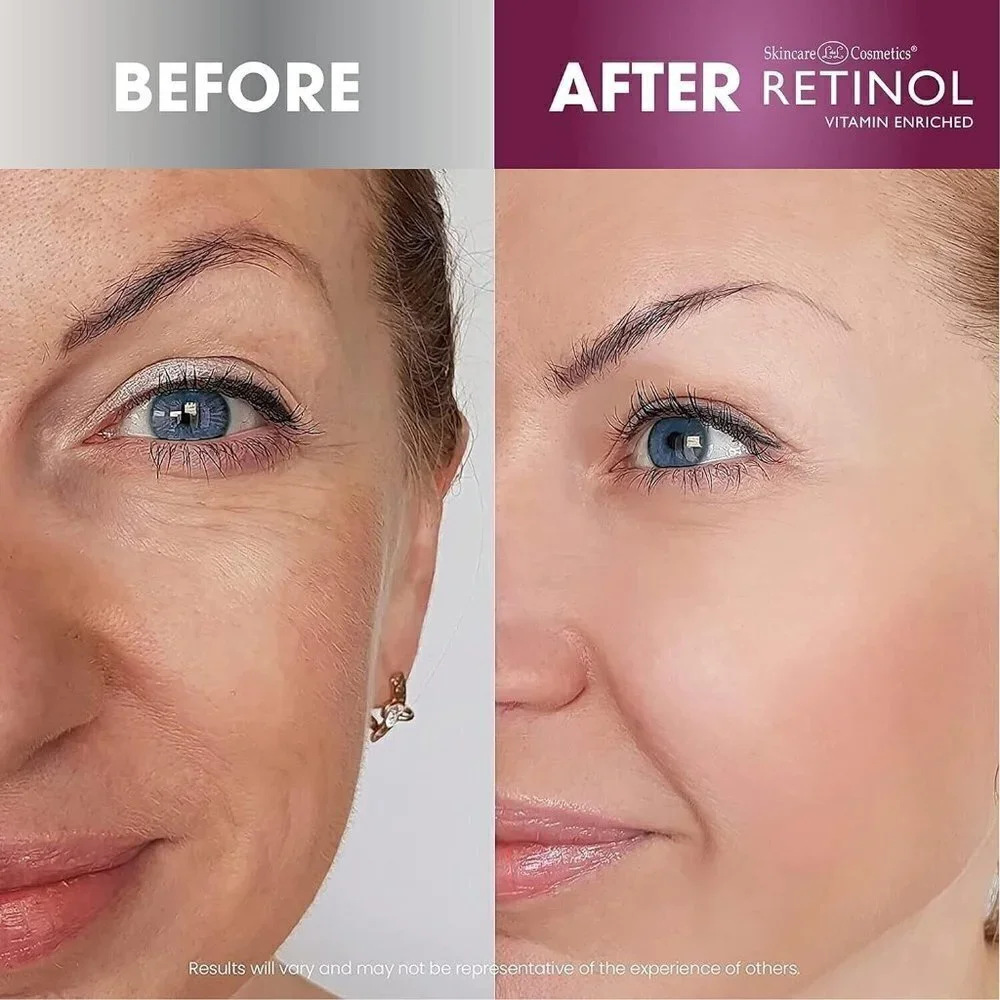 Retinol Night Cream The Original Anti-Aging Retinol For Younger Looking Skin NIB